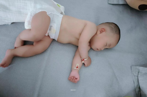 南宁宝宝上火有眼屎